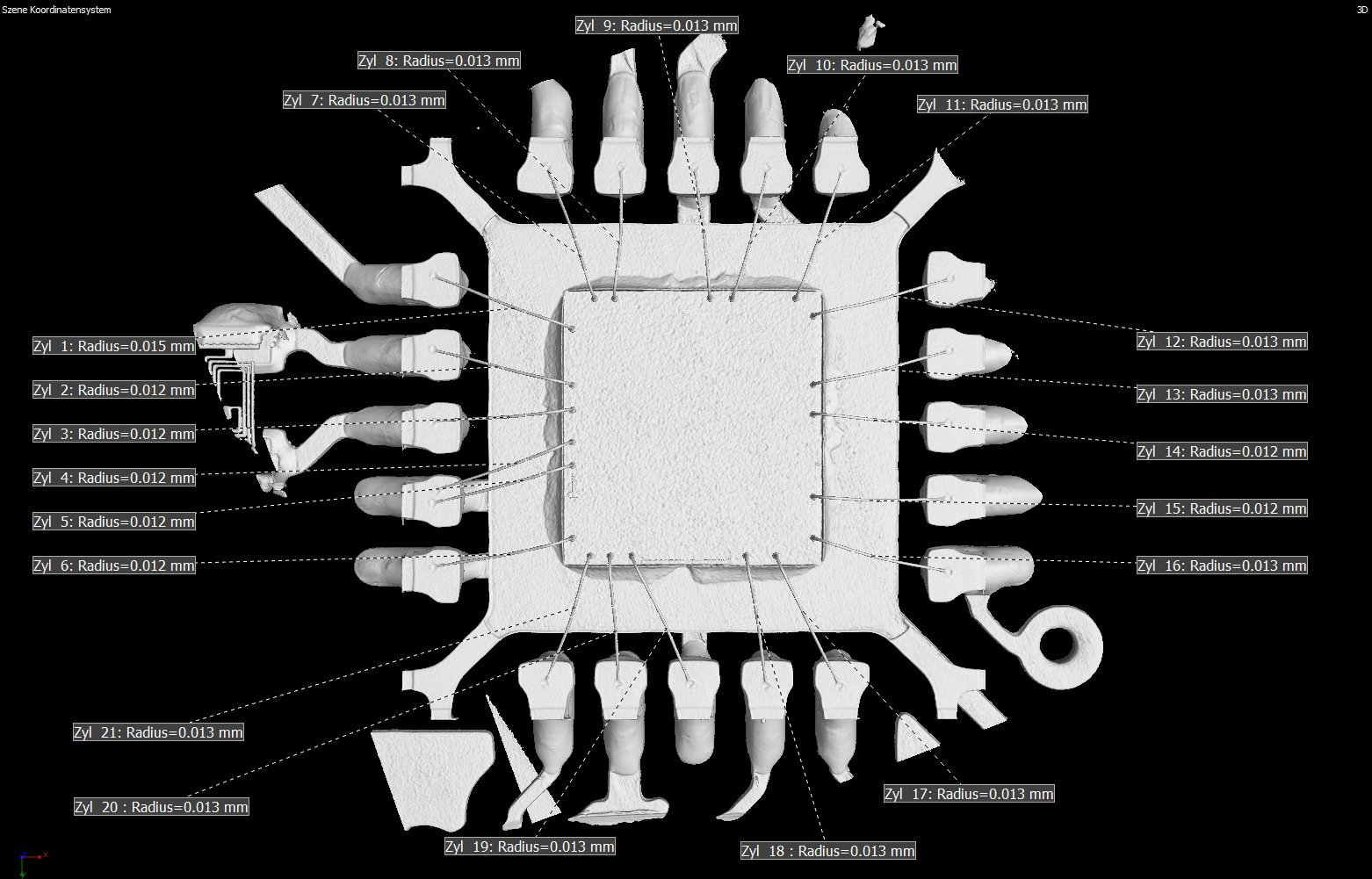 CT-Rekonstruktion